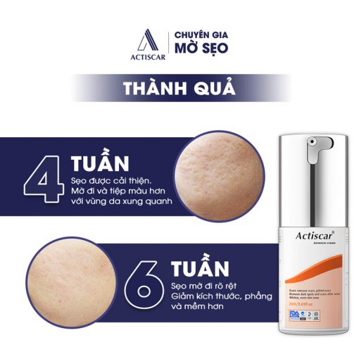 Thành quả của kem trị sẹo lõm Actiscar