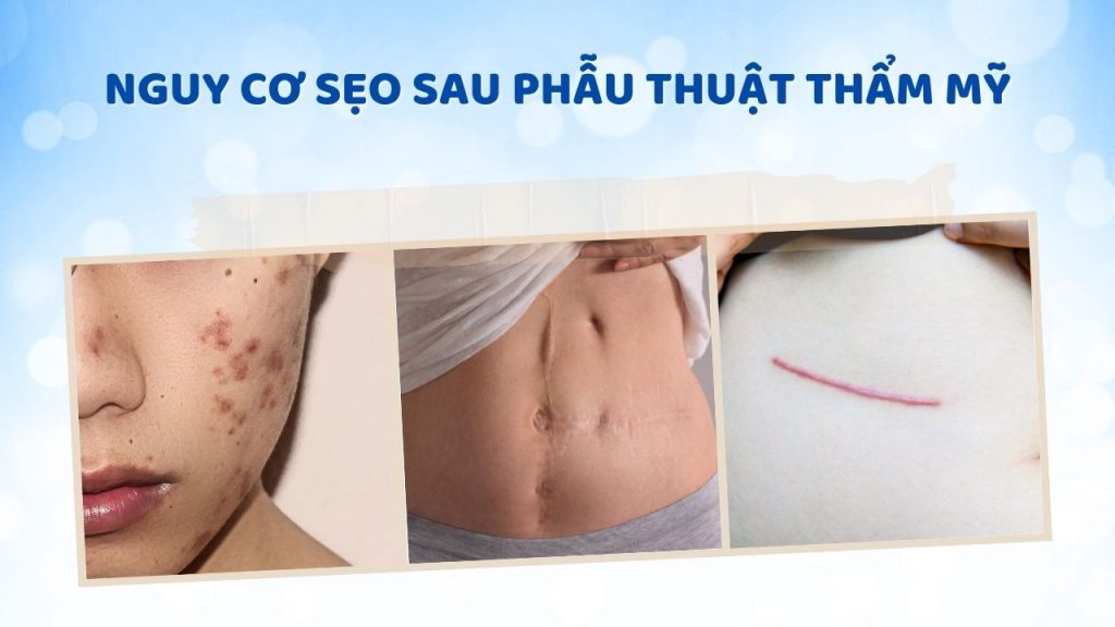 Phẫu thuật thẩm mỹ có nguy cơ để lại sẹo