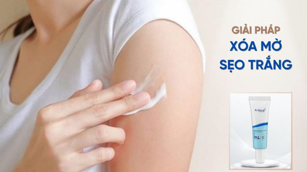 Xoá mờ sẹo với kem đặc trị sẹo trắng chuẩn y khoa