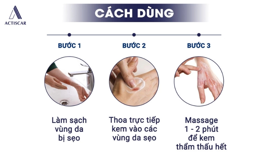 Cách sử dụng bộ đôi kem xoá mờ sẹo lồi Actiscar