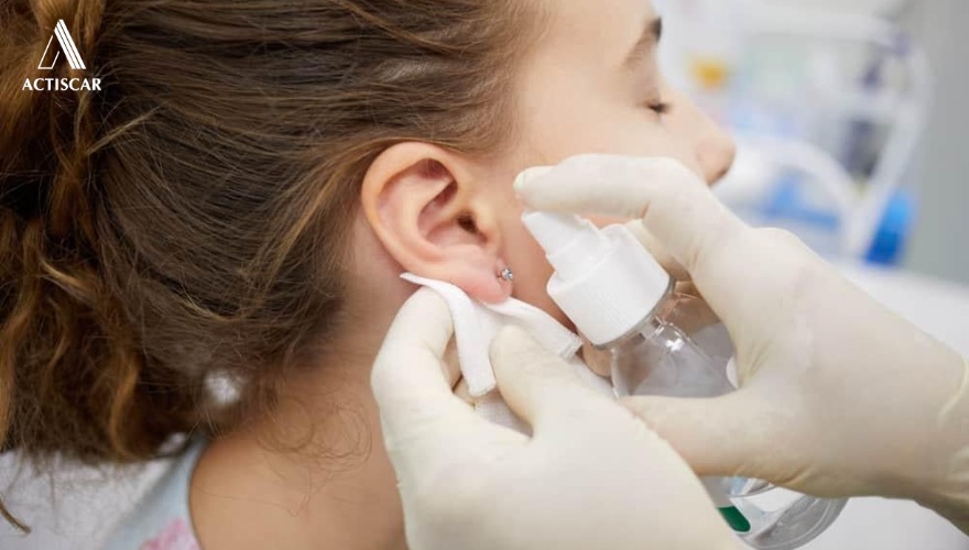 Cách xử lý sẹo lồi vành tai khi còn mới