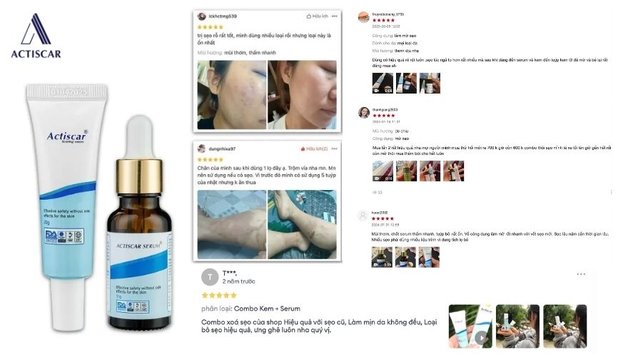 Đánh giá từ khách hàng sử dụng kem mờ sẹo Actiscar