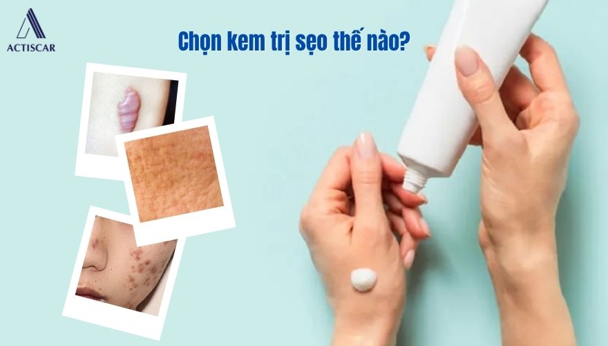 Lựa chọn kem trị sẹo hiệu quả cho từng loại sẹo