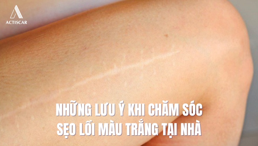 Lưu ý khi chăm sóc sẹo lồi màu trắng tại nhà