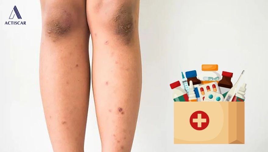 Nguy cơ khi tự dùng thuốc trị sẹo thâm ở chân