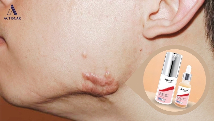Những điều cần lưu ý để tối ưu hiệu quả điều trị