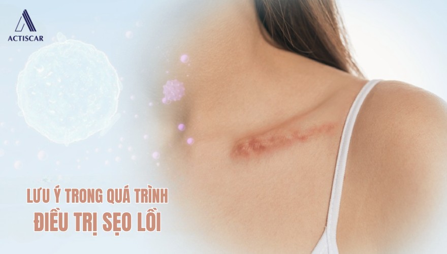 Những lưu ý quan trọng trong quá trình điều trị sẹo lồi