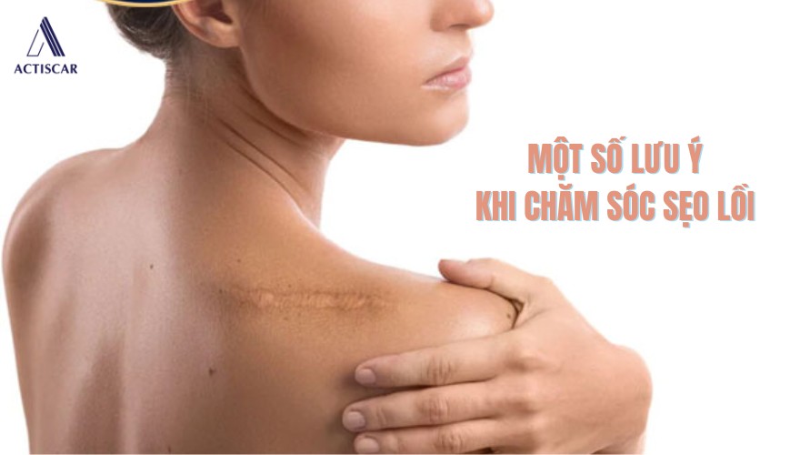 Những vấn đề cần lưu ý khi chăm sóc sẹo lồi