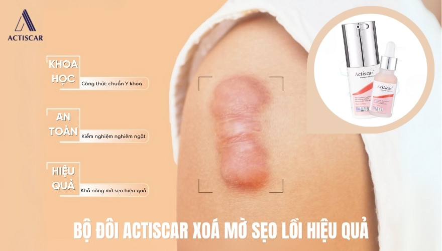Sử dụng cả bộ kem và Serum Actiscar giúp tăng hiệu quả làm mờ sẹo lồi