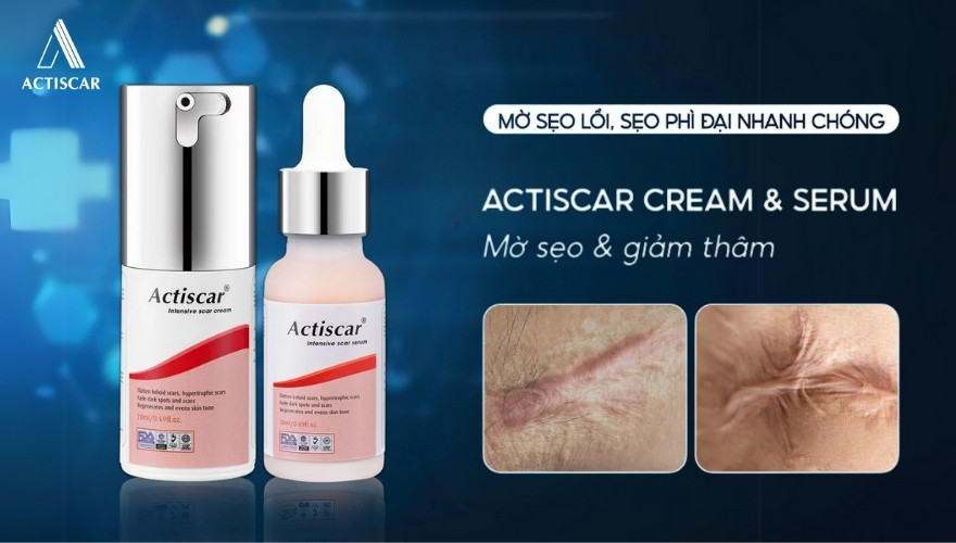 Sử dụng sản phẩm trị sẹo lồi chuyên biệt