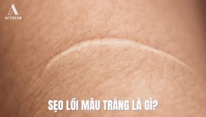 Thế nào là sẹo lồi màu trắng