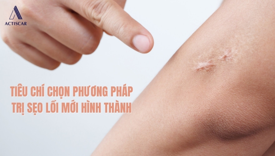 Tiêu chí lựa chọn giải pháp trị sẹo lồi mới hình thành phù hợp