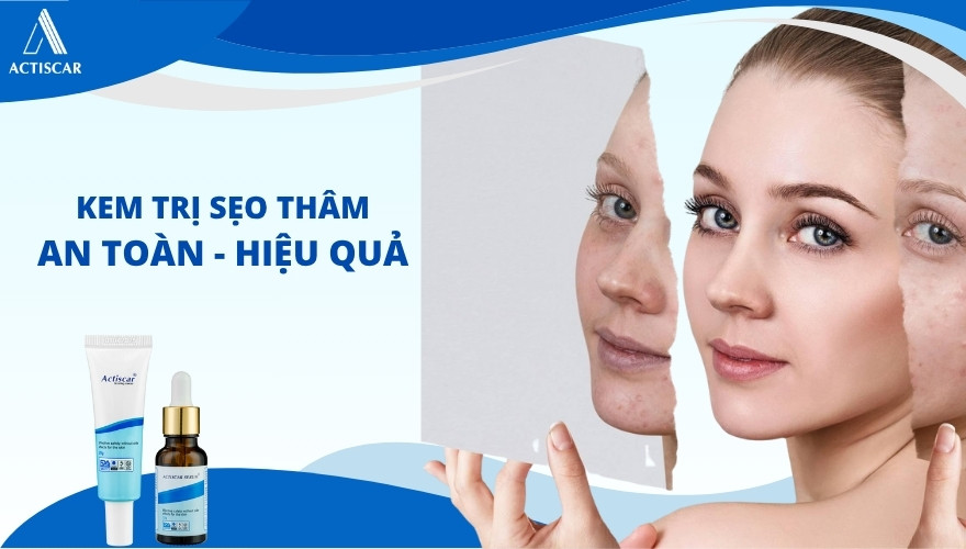 Top kem trị sẹo thâm tốt nhất hiện nay