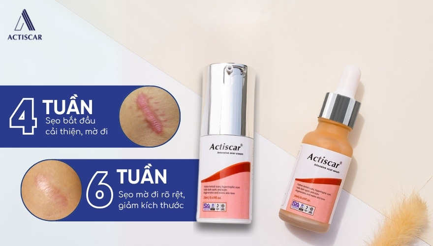 Actiscar - Giải pháp hỗ trợ xử lý sẹo lồi hiệu quả