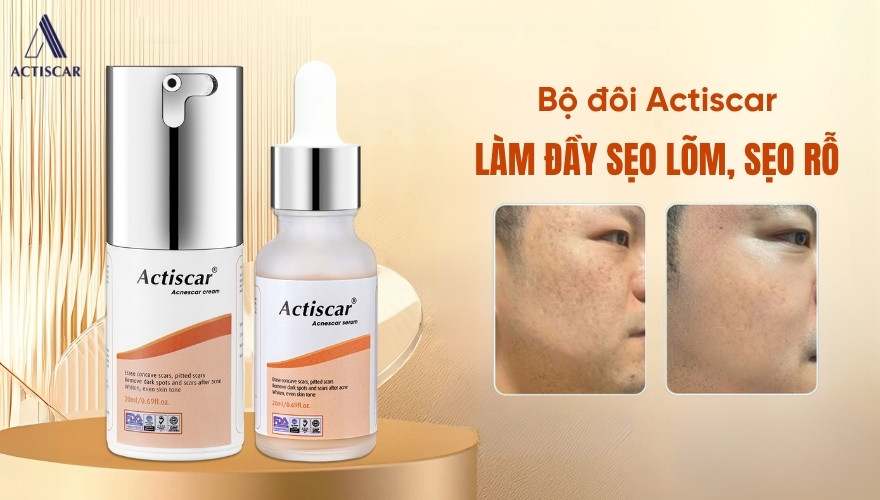 Actiscar - Giải pháp xử lý sẹo rỗ hiệu quả tại nhà