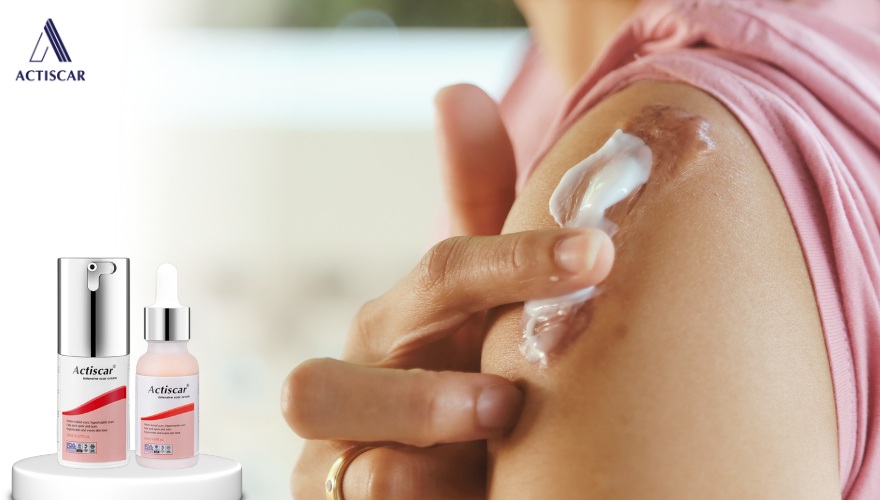 Actiscar sẹo lồi - Giải pháp xoá mờ sẹo toàn diện