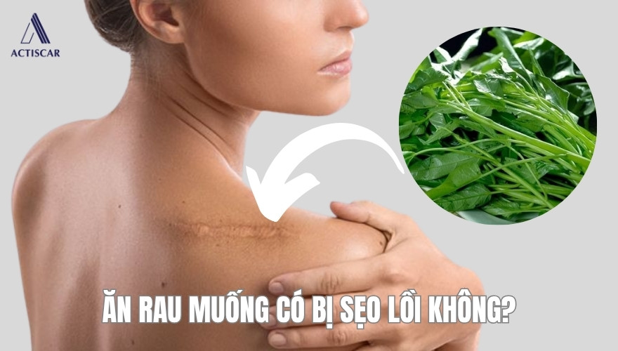 Ăn rau muống có bị sẹo lồi không?