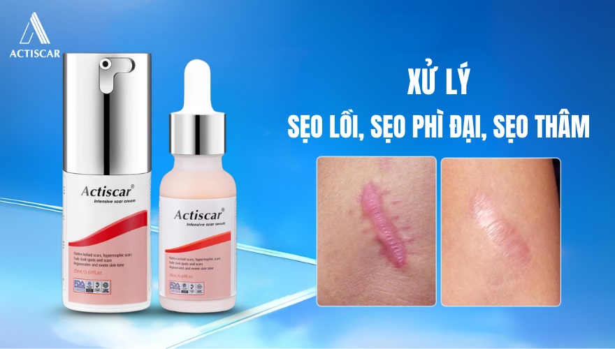 Bộ đôi xử lý sẹo lồi Actiscar giải pháp an toàn cho làn da