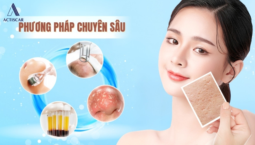 Các giải pháp xử lý sẹo rỗ chuyên sâu