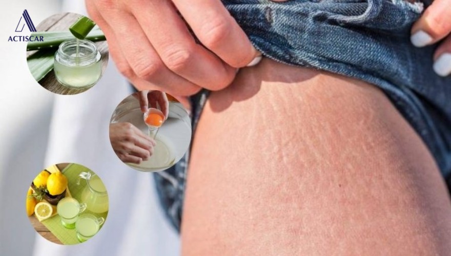 Các phương pháp cải thiện rạn từ tự nhiên