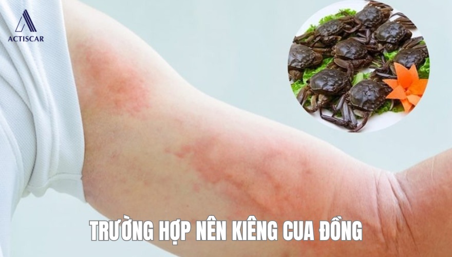 Các trường hợp nên kiêng cua đồng