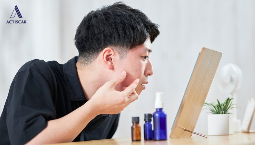 Chăm sóc và ngăn ngừa sẹo rỗ tại nhà