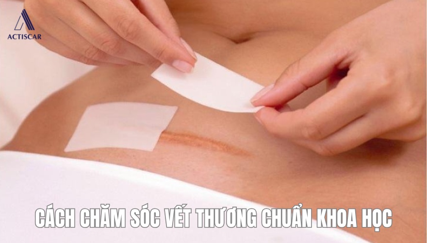 Chăm sóc vết thương chuẩn khoa học giúp hạn chế sẹo