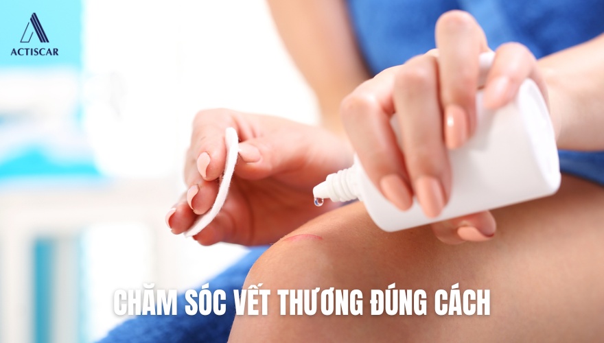 Chăm sóc vết thương đúng cách giúp hạn chế hình thành sẹo xấu
