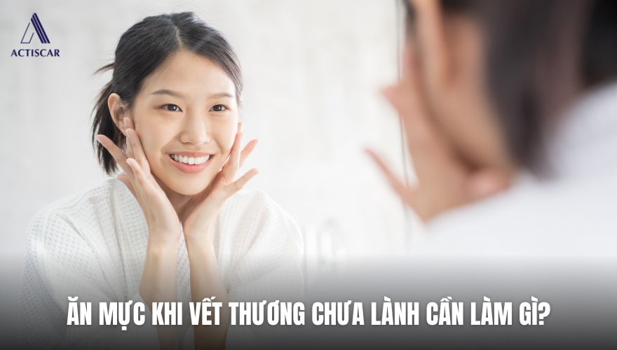 Chăm sóc vết thương khi lỡ ăn mực