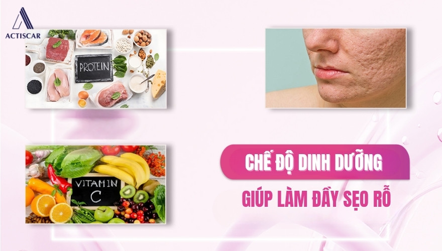 Chế độ dinh dưỡng giúp làm đầy sẹo lõm