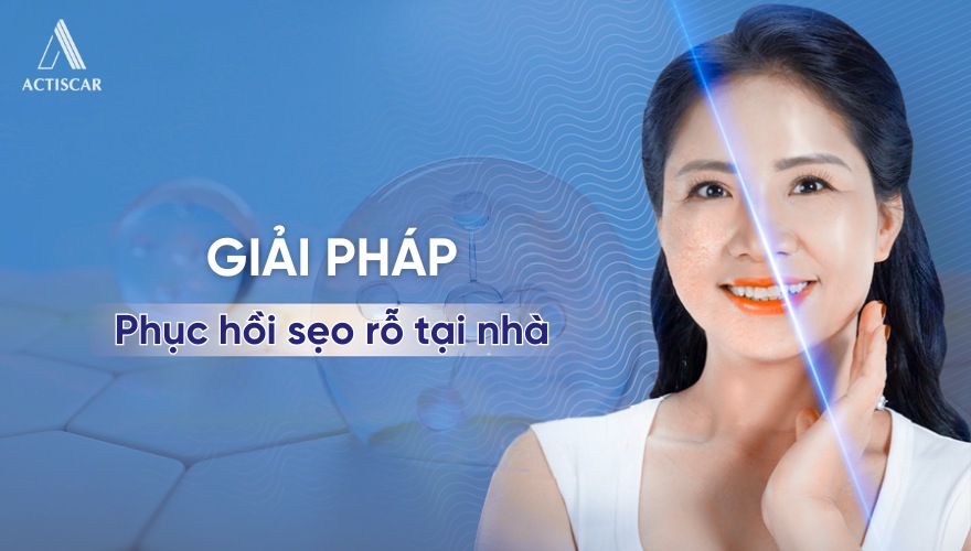 Giải pháp cải thiện sẹo rỗ đáy nhọn tại nhà