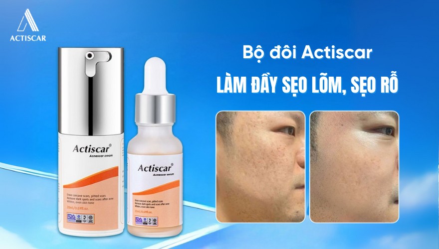 Giải pháp mờ sẹo an toàn tại nhà