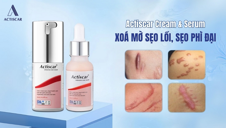 Giải pháp xoá mờ sẹo lồi, sẹo phì đại với bộ đôi Actiscar sẹo lồi