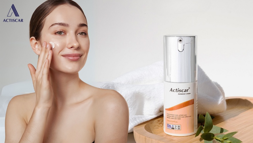 Kem mờ sẹo, sự kết hợp hoàn hảo với Serum sẹo lõm
