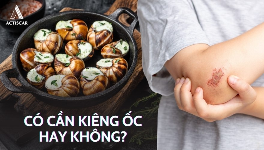 Có cần ăn kiêng ốc hay không?