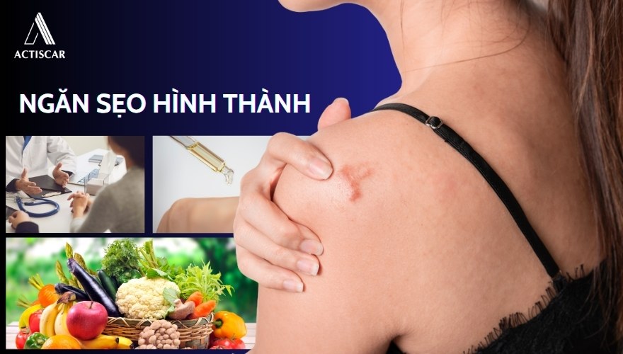 Phương pháp ngăn sẹo hình thành