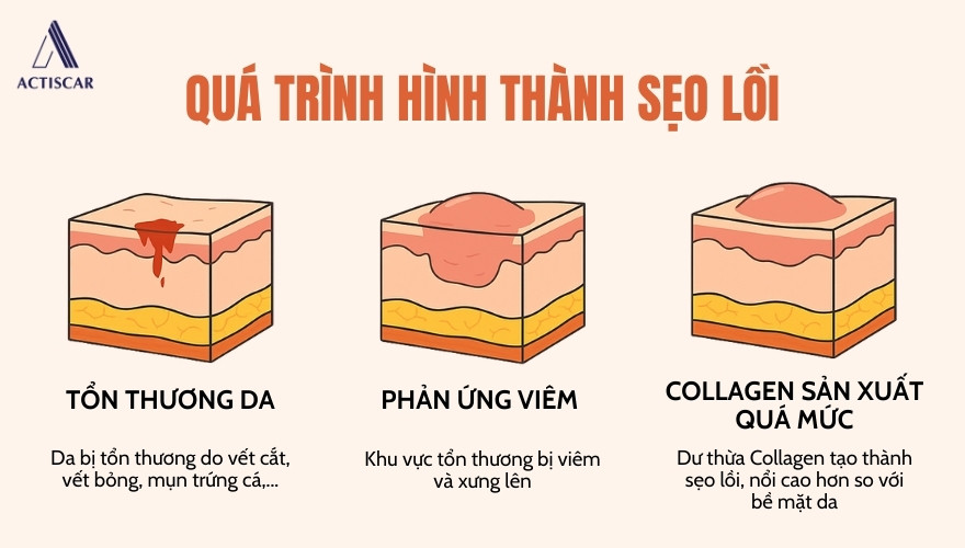 Quá trình hình thành của sẹo lồi trên da