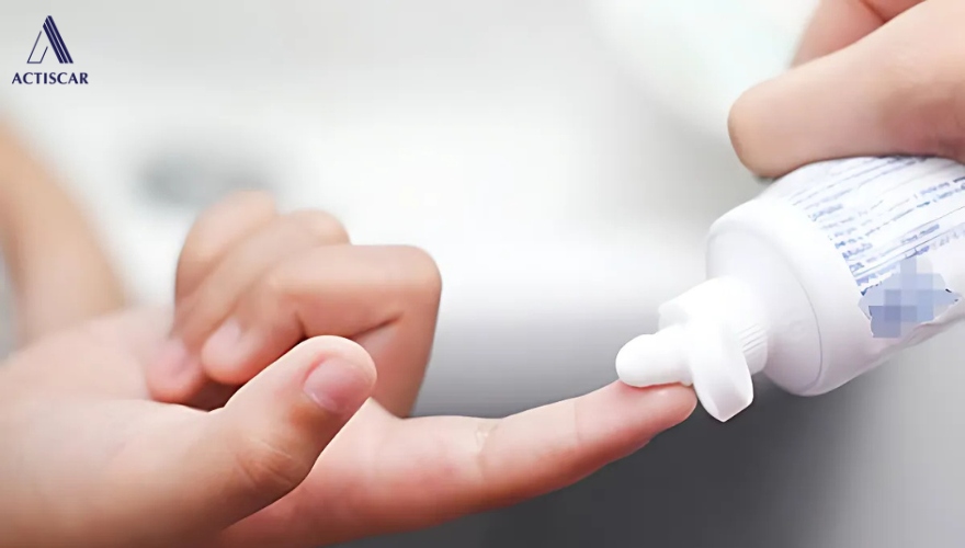 Sự thật về việc trị sẹo rỗ bằng kem đánh răng