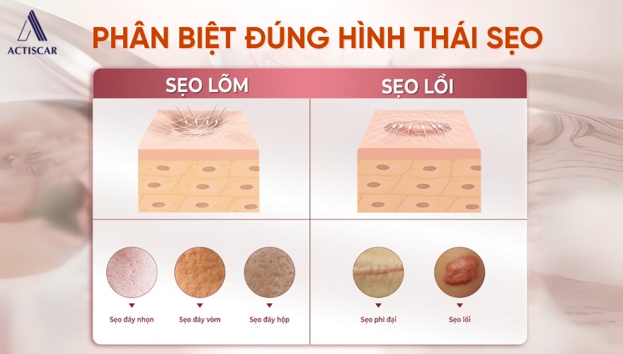 Vai trò của việc phân biệt đúng hình thái sẹo