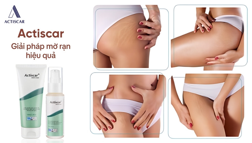 Actiscar - Giải pháp hỗ trợ làm mờ rạn hiệu quả