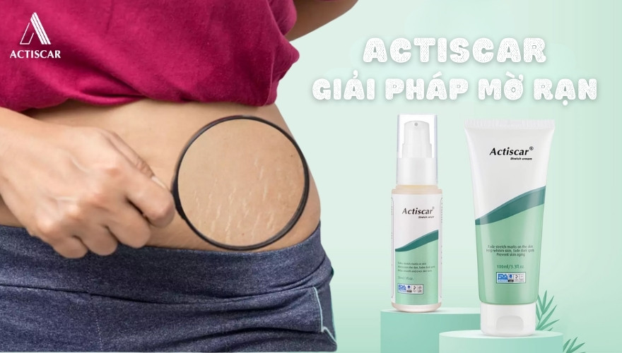Actiscar - giải pháp mờ rạn da an toàn