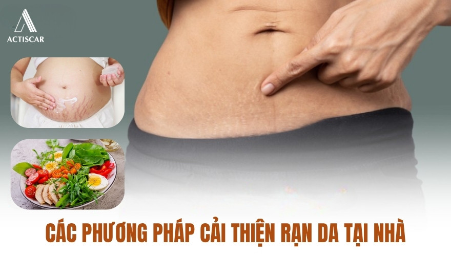 Các phương pháp chăm sóc và xử lý rạn tại nhà