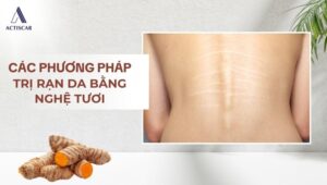Các phương pháp trị rạn da bằng nghệ tươi