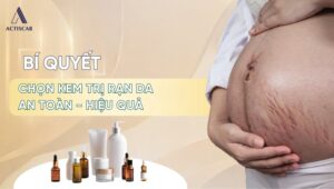 Cách chọn kem trị rạn da cho bà bầu