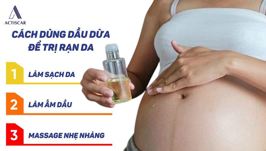 Cách dùng dầu dừa để trị rạn da cho bà bầu