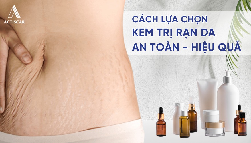 Cách lựa chọn kem trị rạn da an toàn cho mẹ sau sinh