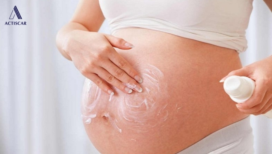 Cách phòng ngừa rạn xuất hiện khi mang thai
