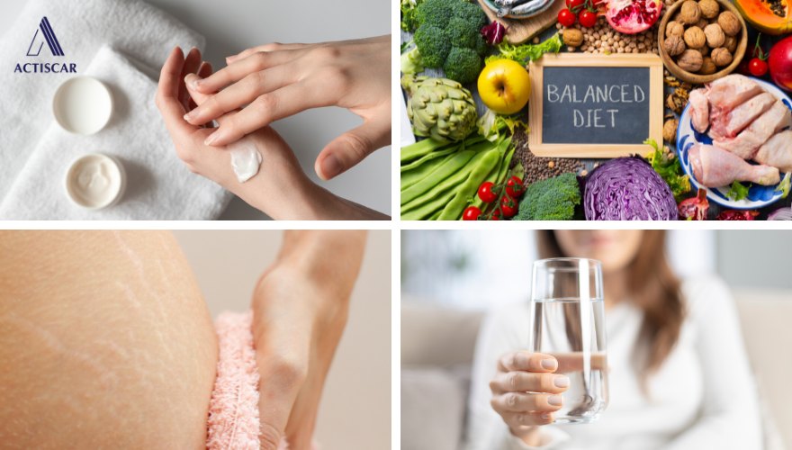 Cải thiện rạn da bằng cách chăm sóc tại nhà