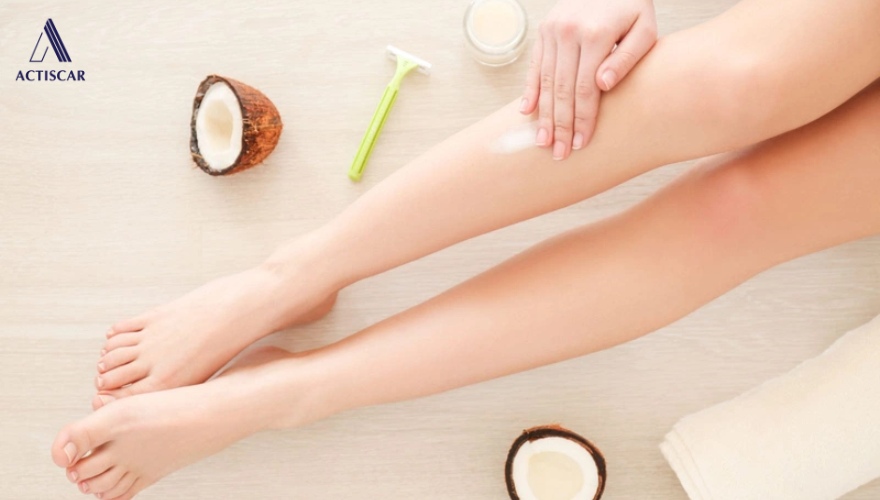 Chăm sóc da rạn ở bắp chân đơn giản tại nhà