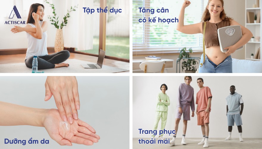 Chăm sóc và phòng ngừa rạn da ở mông